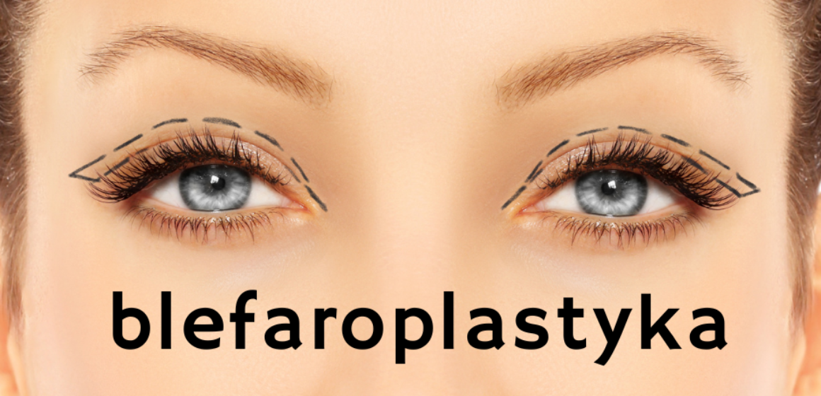 blefaroplasyka blefaroplasyka